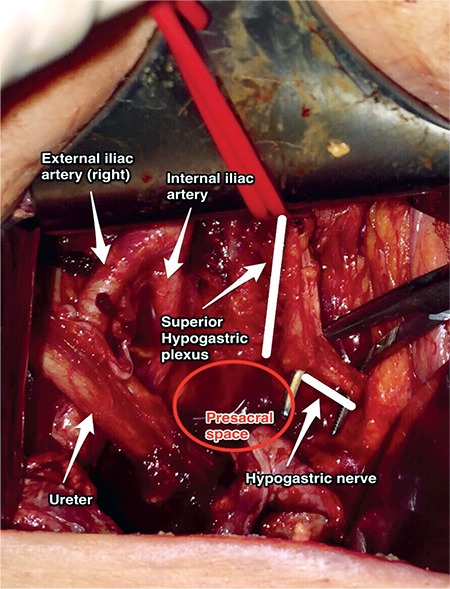 Figure 18