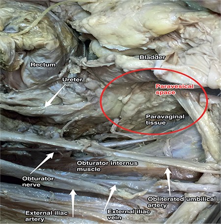 Figure 16