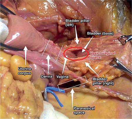 Figure 21