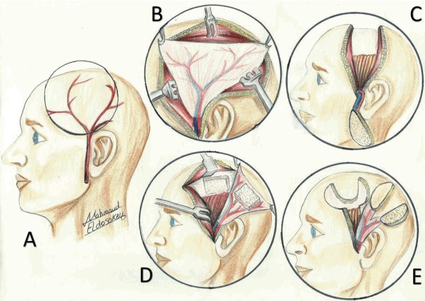 Fig. 1.