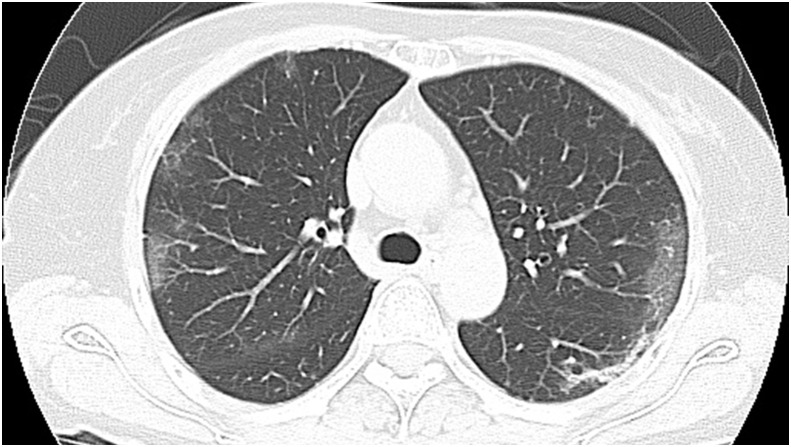 Fig. 1