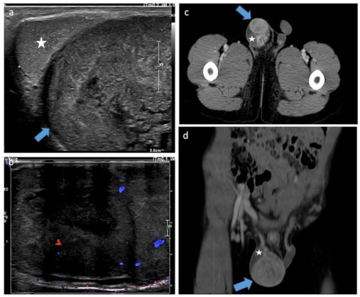 Figure 14