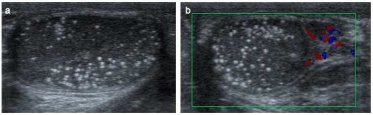 Figure 15