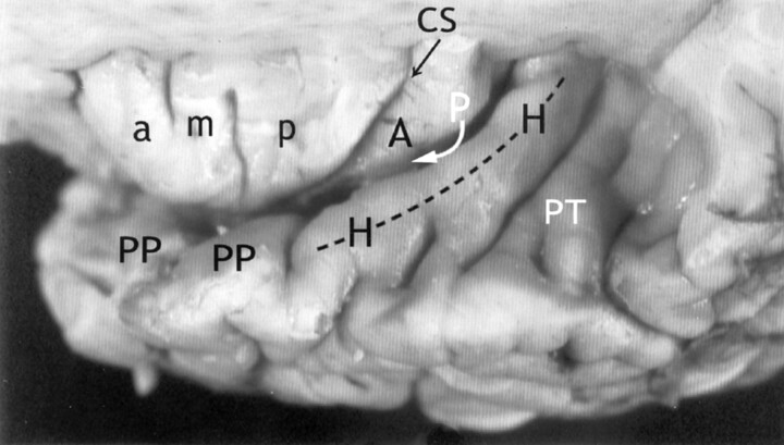 Fig 4.