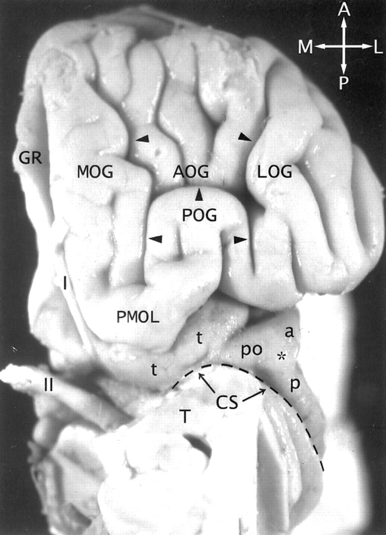 Fig 2.