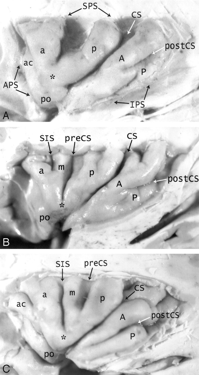 Fig 1.