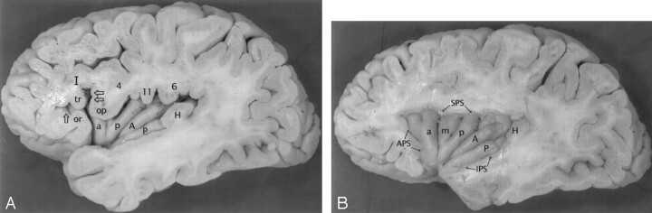 Fig 3.