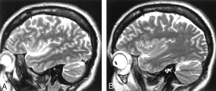 Fig 7.