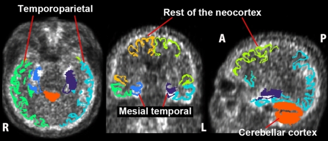 Fig. 1
