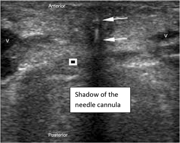 Fig. 2