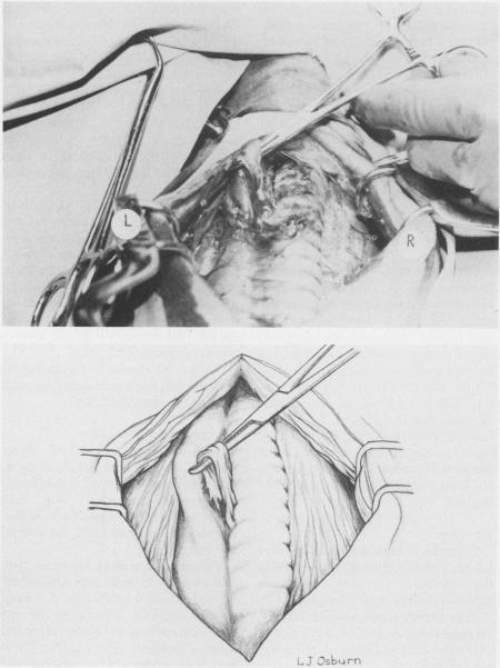 Figure 2a and b.