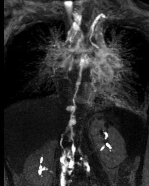 graphic file with name 247_2013_2638_Figdl_HTML.jpg