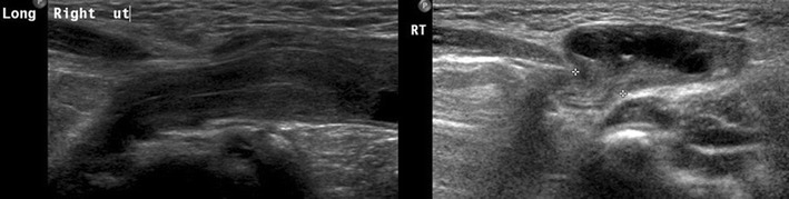 graphic file with name 247_2013_2638_Figdk_HTML.jpg