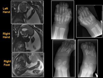 graphic file with name 247_2013_2638_Figcy_HTML.jpg