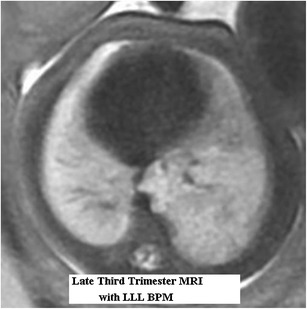 graphic file with name 247_2013_2638_Figbe_HTML.jpg