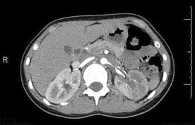 graphic file with name 247_2013_2638_Figcj_HTML.jpg