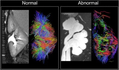 graphic file with name 247_2013_2638_Figap_HTML.jpg