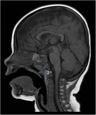 graphic file with name 247_2013_2638_Figax_HTML.jpg