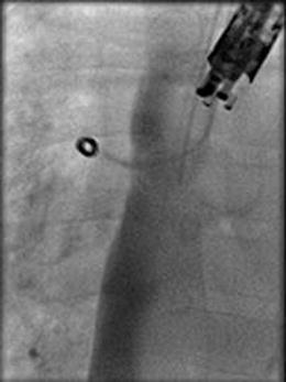 graphic file with name 247_2013_2638_Figcm_HTML.jpg