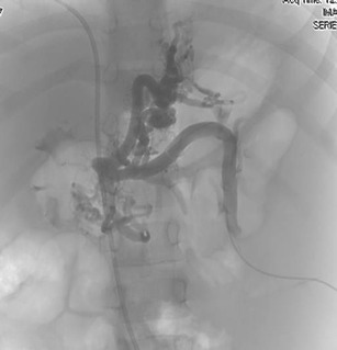 graphic file with name 247_2013_2638_Figct_HTML.jpg