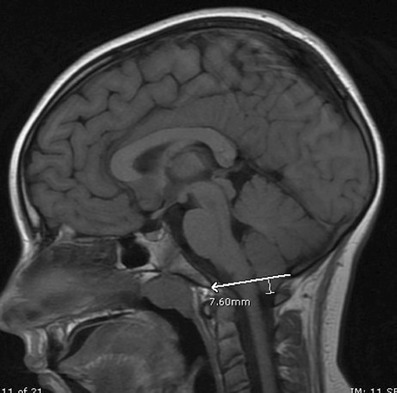 graphic file with name 247_2013_2638_Figdt_HTML.jpg