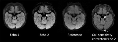 graphic file with name 247_2013_2638_Figr_HTML.jpg