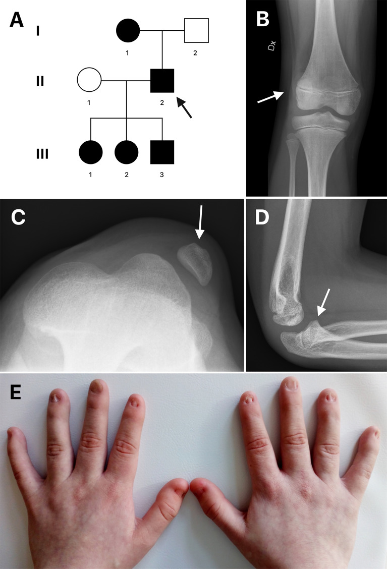 Figure 1