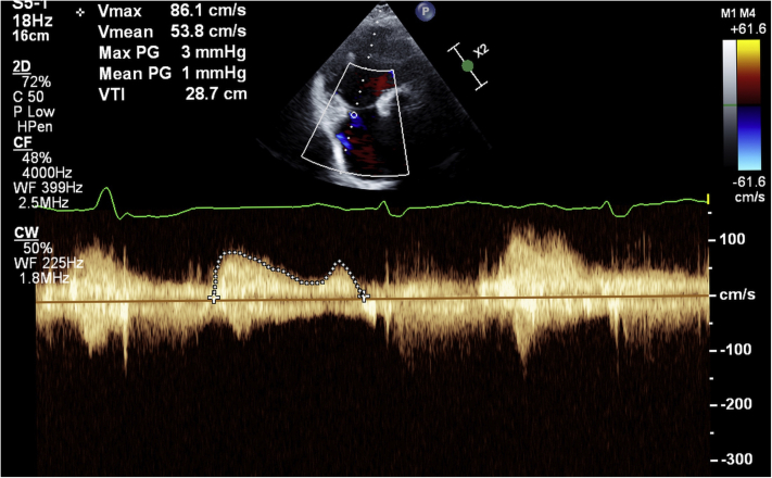 Figure 4