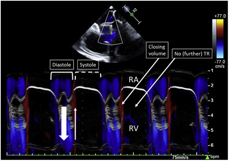 Figure 2