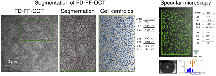 Fig. 12.