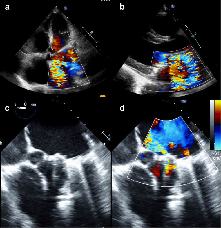 Fig. 2