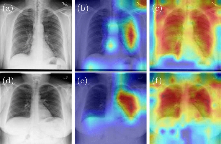 Fig. 11