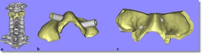 Fig. 1