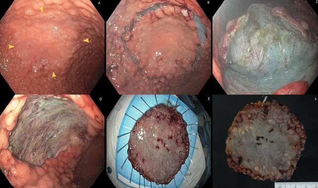 graphic file with name 10689_2021_284_Figk_HTML.jpg