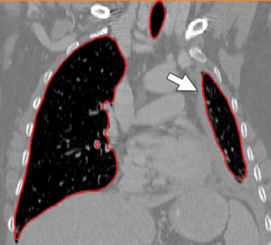 Figure 10e