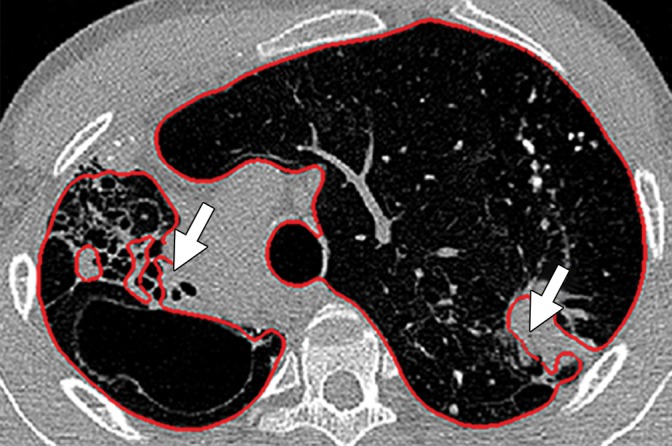 Figure 10c