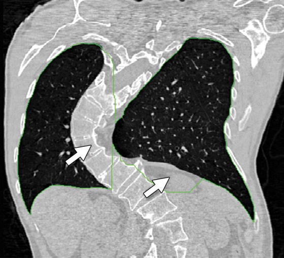 Figure 13a