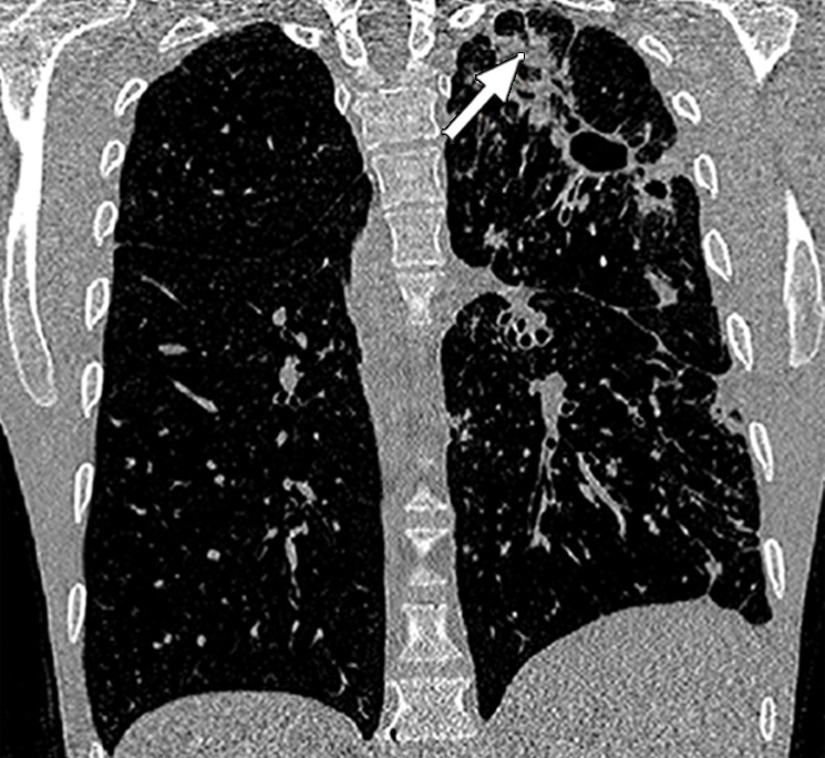 Figure 2c