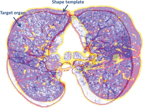 Figure 12a