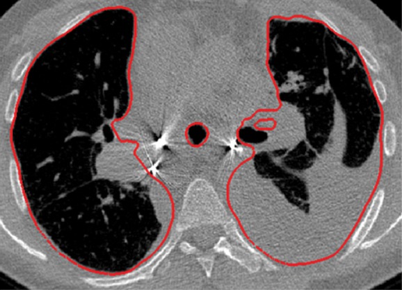 Figure 16a