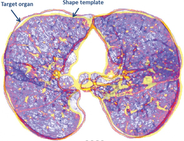 Figure 12b