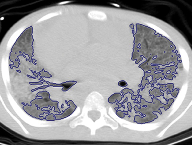 Figure 6b