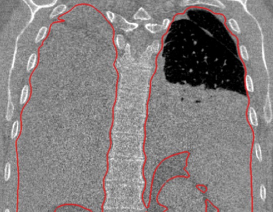 Figure 16d