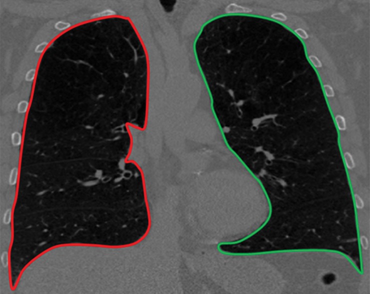 Figure 1b