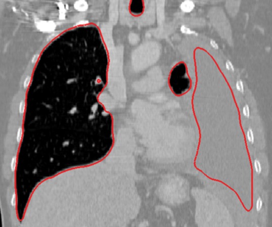 Figure 16f