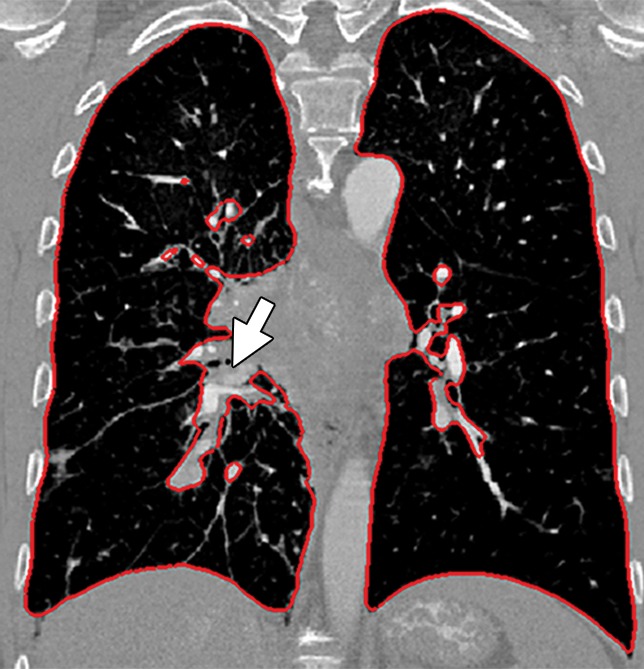 Figure 10d