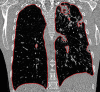 Figure 2d