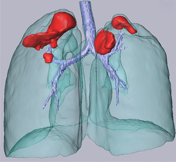 Figure 9d