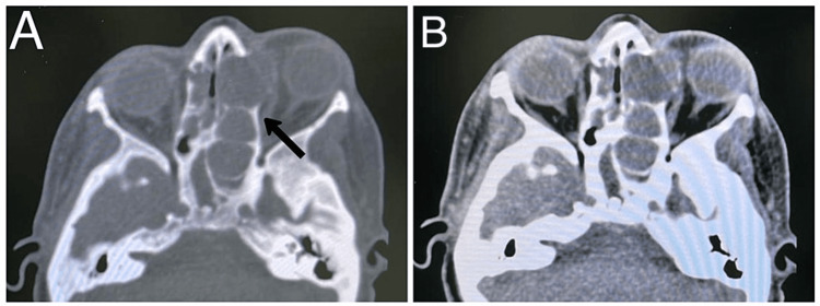 Figure 6