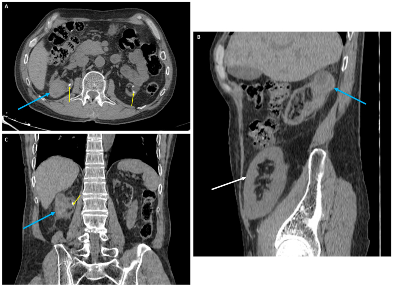 Fig. 1